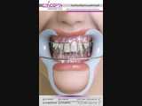 ارتودنسی یعنی علم، دانش و مهارت اصلاح دندان‌ها | کلینیک تخصصی دندانپزشکی کانسپتا 