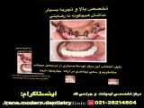 ايمپلنت تخصصي دندان