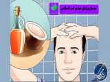 درمان جلوگیری از ریزش مو | طب اسلامی شیعی 12