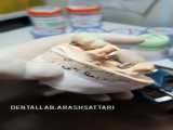ساخت پروتز های متکی بر ایمپلنت- لابراتوار دندانسازی آرش ستاری