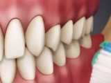 روش صحیح مسواک زدن | کلینیک تخصصی دندانپزشکی کانسپتا 