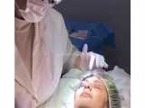 فیلم جراحی پلک بالا در اتاق عمل 