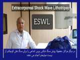 ESWL KIDNEY STONE TREATMENT IN IRAN