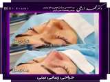 قبل و بعد جراحی بینی توسط دکتر ارمی