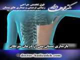 بازسازی پستان پس از درمان سرطان | دکتر هادیزاده | جراح سینه تهران