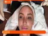 آموزش پاکسازی صورت | فیشیال پوست ( درماپلنینگ )