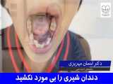 دندان شیری را بی مورد نکشید | دکتر احسان مهریزی 