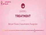 درمان سرطان پستان با حفظ بافت سینه 