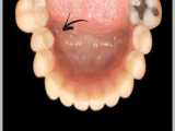 حرکت ارتودنسی دندان | دکتر احسان مهریزی 