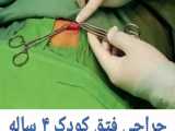 انجام عمل جراحی فتق کودک 4 ساله در مرکز جراحی محدود ایرانیان ‌