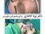 فیلم جراحی بینی توسط دکتر پریا حامدی