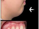ارتودنسی ثابت و متحرک | کلینیک دندانپزشکی ایده آل 