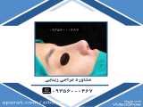 عمل جراحی بینی مشهد