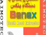 استخراج دندان با دستگاه Benex