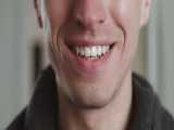 تایم لپس ارتودنسی دندان (ببینید ارتونسی چطور دندان ها رو منظم میکنه)