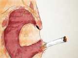 How do cigarettes affect the body? - Krishna Sudhir 