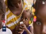 سوءتغذیه کودکان در هائیتی؛ یونیسف هشدار داد 