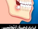 کشیدن دندان عقل برای درمان ارتودنسی | دکتر فرهاد گرجی 