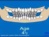 مراحل رشد دندانهاى موقت و دائم در مراحل سنى