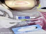 رعایت بهداشت دهان در حین درمان ارتودنسی