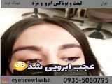 لیفت و بوتاکس ابرو و مژه 