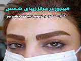 فیبروز در مرکز زیبای شمس
