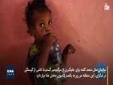 هشدار درباره مرگ قریب‌الوقوع ۱۰۰ هزار کودک در اتیوپی 
