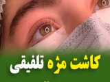 کاشت مژه تلفیقی برای مژه های آسیب دیده