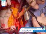 1400.05.24 - عمل جراحي AVR Aortoplasty Septal Myectomy