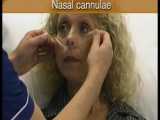 آموزش استفاده از کانولای دوشاخه بینی جهت اکسیژن رسانی 