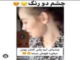 چشم دو رنگ!