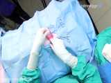 ویدیوی کامل جراحی عقیم سازی گربه ماده