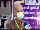 بستری ۵۶ بیمار مبتلا به قارچ سیاه در تهران|تخلیه چشم فرد مبتلا به این بیماری