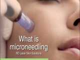میکرونیدلینگ پوست صورت
