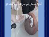 مراقبت بعد از کاشت مو 
