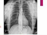 مقدمات بیماری های تنفس جلسه 2 
