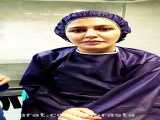 جراحی بینی باز اتاق عمل دکتر نسرین راستا۰۹۳۳۷۱۷۴۸۰۴