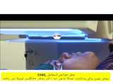 فیلم عمل جراحی اسمایل SMIL دکتر یاسر خاکپور جراح و متخصص چشم