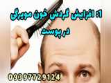 تونیک رفع ریزش مو تضمینی مرجوعی 09397729124