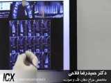 جراحی ایمپلنت تک واحدی ( دکتر فلاحی )