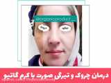 رفع چروک و تیرگی صورت با کرم گاتیو