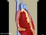 علل ایجاد سکته قلبی(Myocardial infarction)