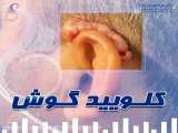 کلیوئید گوش