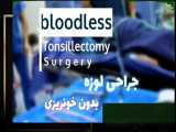 جراحی لوزه (بیمار بزرگسال) بدون خونریزی توسط دکتر یحیوی