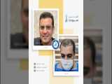 کاشت مو سرودی | بندرعباس - soroudi hair transplant