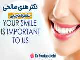 ونیر کامپوزیت دندان در اصفهان | دکتر هدی صالحی دندانپزشک زیبایی
