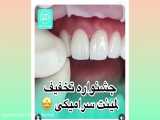 کلینبک دندانپزشکی مهر (mehr_dental_clinic) جشنواره تخفیف لمینت سرامیکی