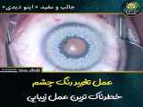 ویدیو عمل جراحی تغییر رنگ چشم
