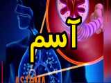 چگونه یک فرد به آسم مبتلا می شود؟