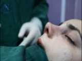 چندین سال پس از جراحی زیبایی بینی